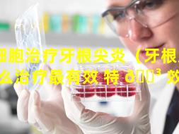 干细胞治疗牙根尖炎（牙根尖炎怎么治疗最有效 特 🐳 效药）